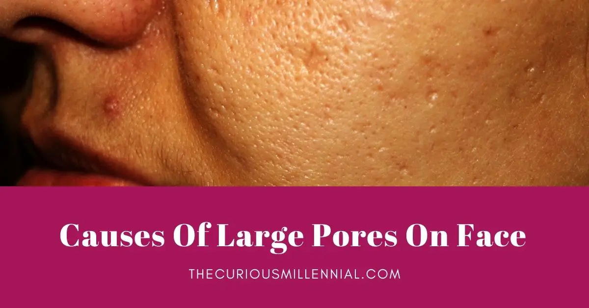 what causes large pores on face