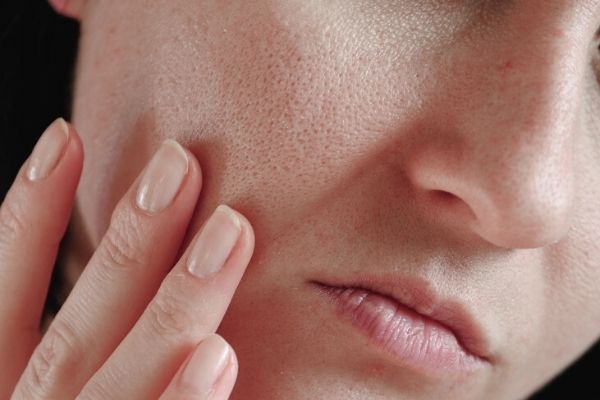 open pores on oily skin
