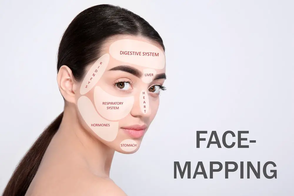 acne face map acne chart for face