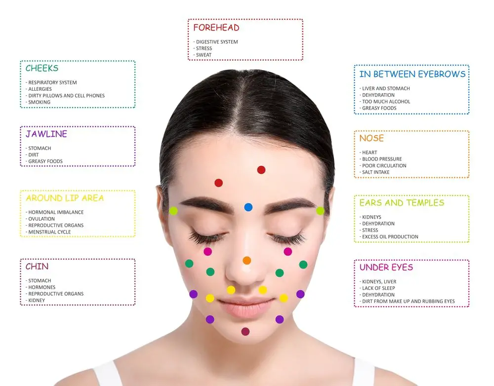 Acne Face Map What Your Acne Says About Your Health