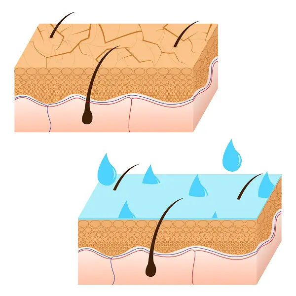 oily skin and dry skin illustration