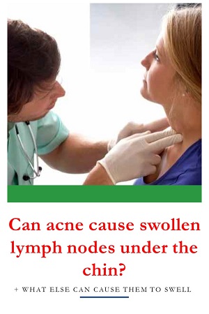 can acne cause lymph nodes to swell
