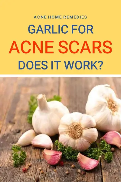 can garlic work for acne scars 