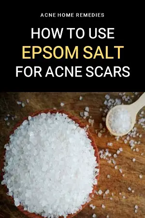 how to use epsom salt to clear acne scars