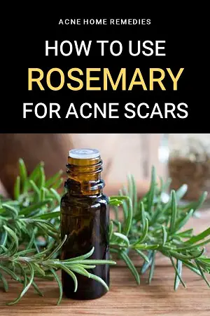how to use rosemary for acne scars