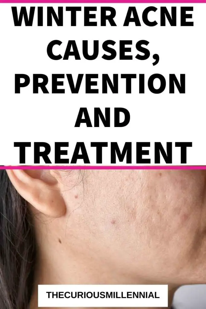 Winter Acne Causes, Prevention And Treatment The Curious Millennial