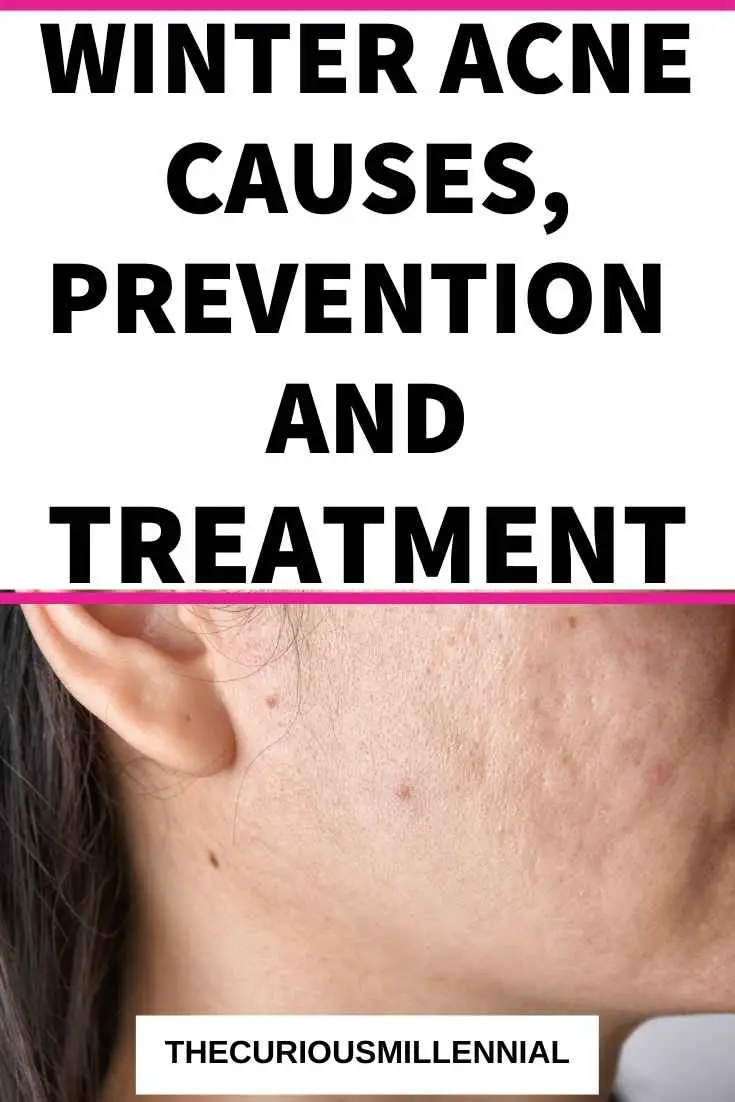 winter-acne-causes-prevention-and-treatment-the-curious-millennial