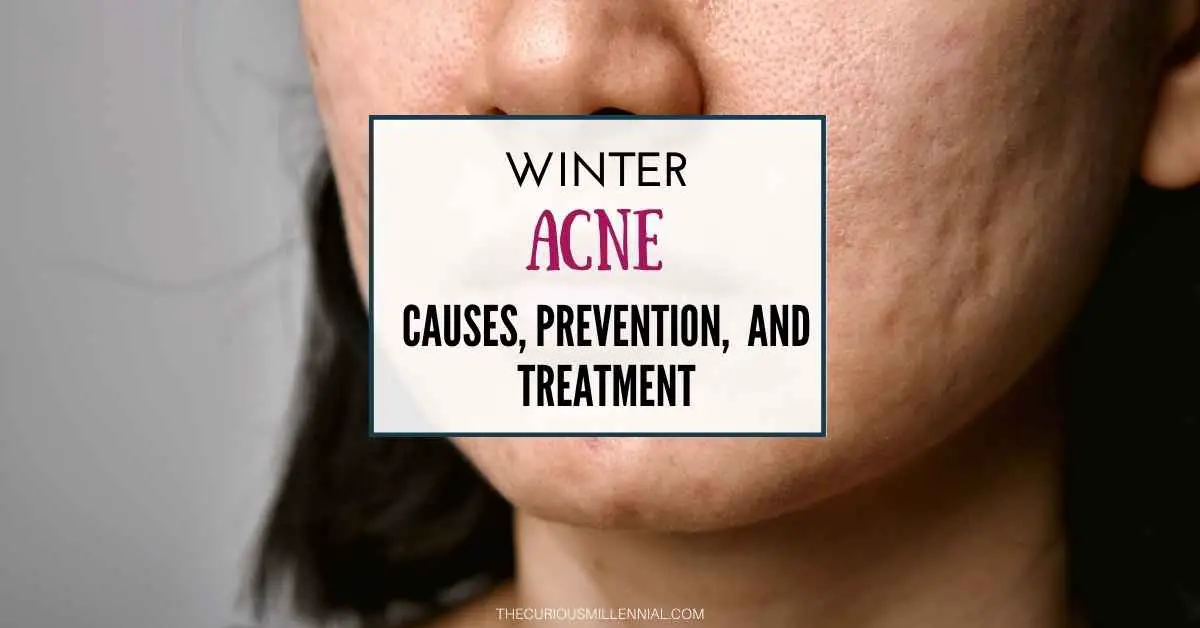 preventing acne in cold weather